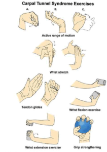 Carpal-tunnel-exercies