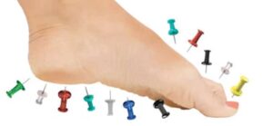 Peripheral-Neuropathy-foot-pins