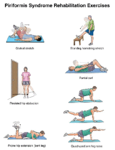 Piriformis-Syndrome-Exercises