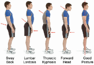Poor-Posture-back-pain