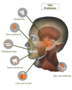 TMJ-problems