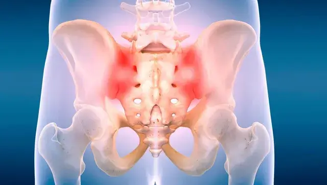 Sacroiliac Joint Pain Image